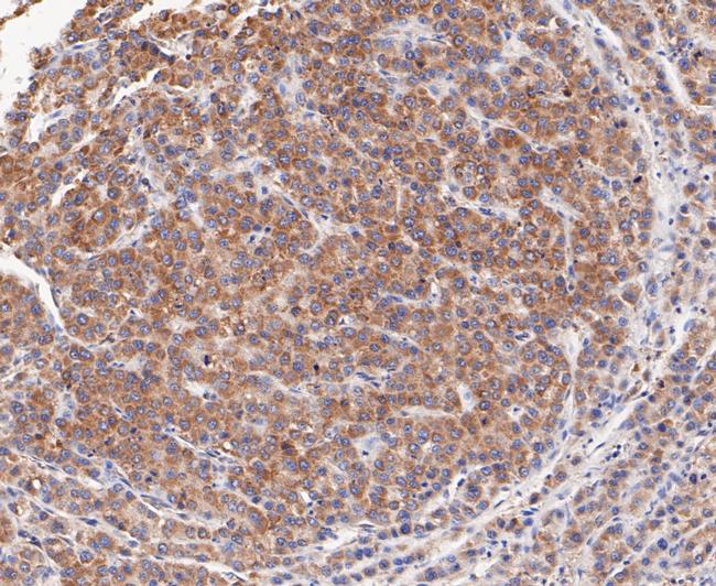 TCP1 Antibody in Immunohistochemistry (Paraffin) (IHC (P))