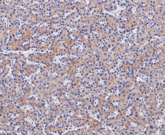 ENTPD5 Antibody in Immunohistochemistry (Paraffin) (IHC (P))