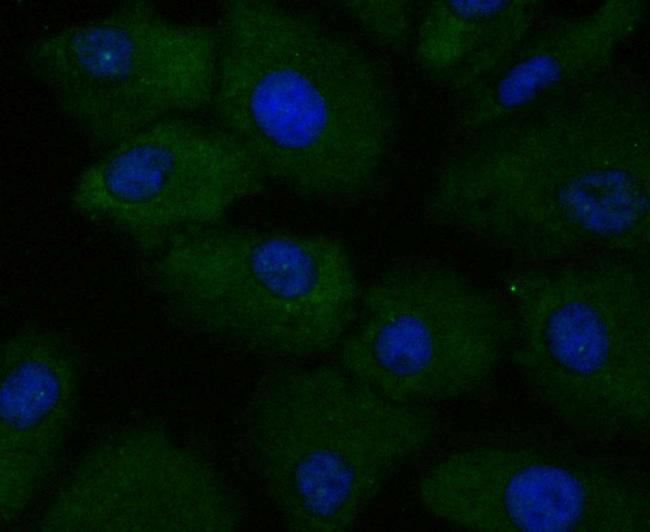 APRIL Antibody in Immunocytochemistry (ICC/IF)