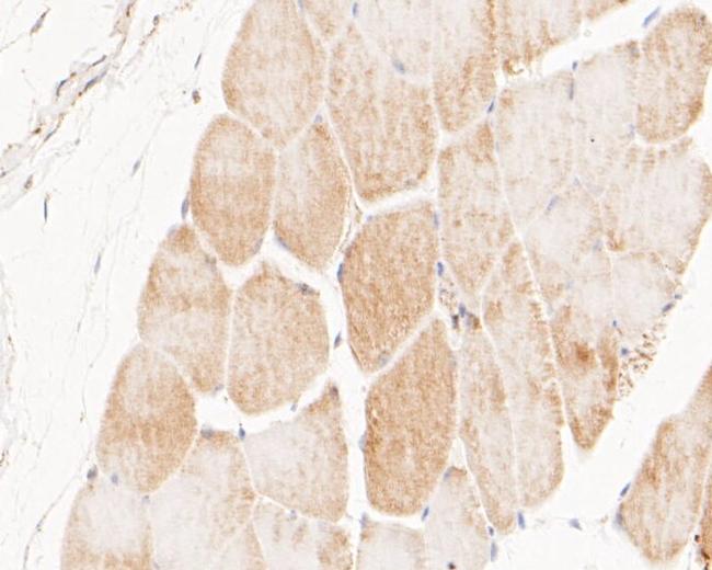 NEK7 Antibody in Immunohistochemistry (Paraffin) (IHC (P))