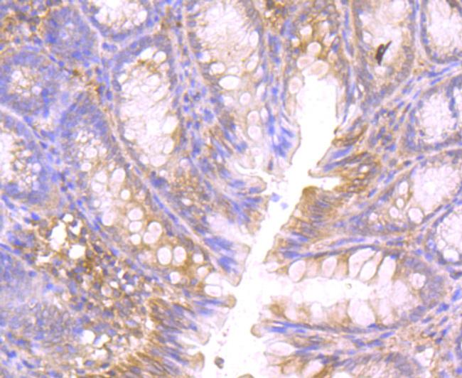 CTHRC1 Antibody in Immunohistochemistry (Paraffin) (IHC (P))