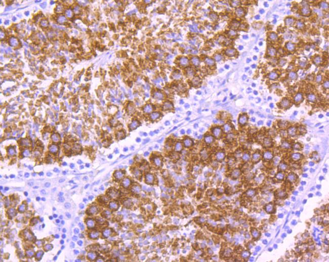 YBX2 Antibody in Immunohistochemistry (Paraffin) (IHC (P))