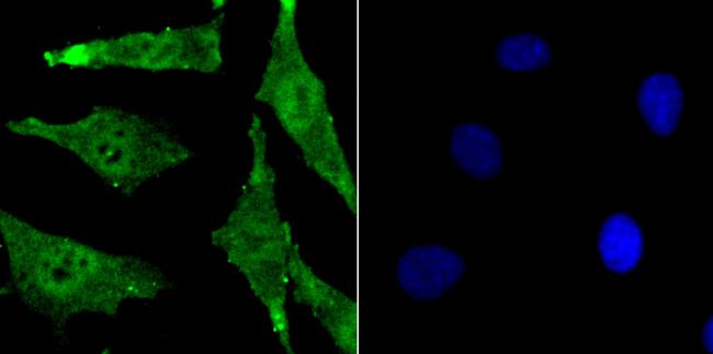 BMI-1 Antibody in Immunocytochemistry (ICC/IF)