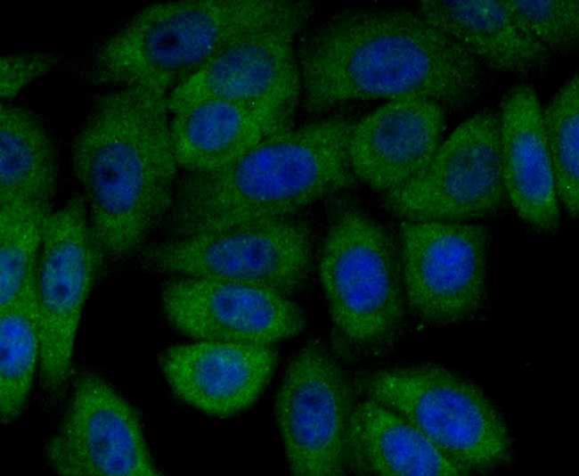 PI3K p85 alpha Antibody in Immunocytochemistry (ICC/IF)