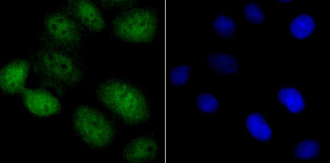 NFIB Antibody in Immunocytochemistry (ICC/IF)