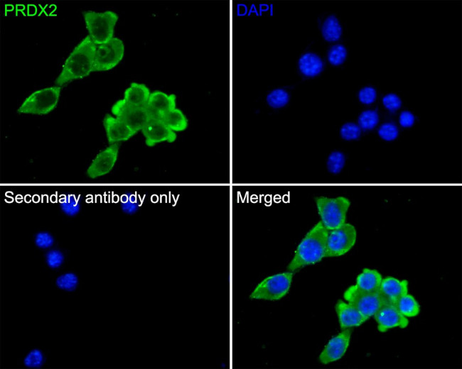 PRDX2 Antibody in Immunocytochemistry (ICC/IF)