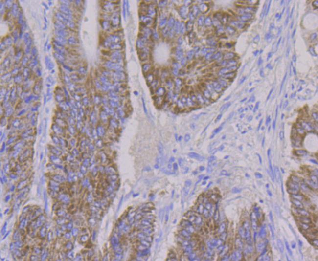 ALDH4A1 Antibody in Immunohistochemistry (Paraffin) (IHC (P))