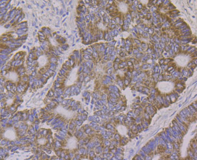 ALDH4A1 Antibody in Immunohistochemistry (Paraffin) (IHC (P))