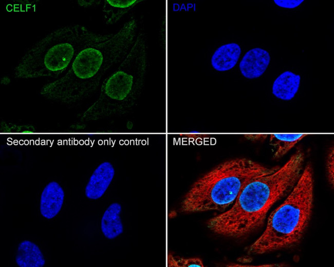 CUGBP1 Antibody in Immunocytochemistry (ICC/IF)