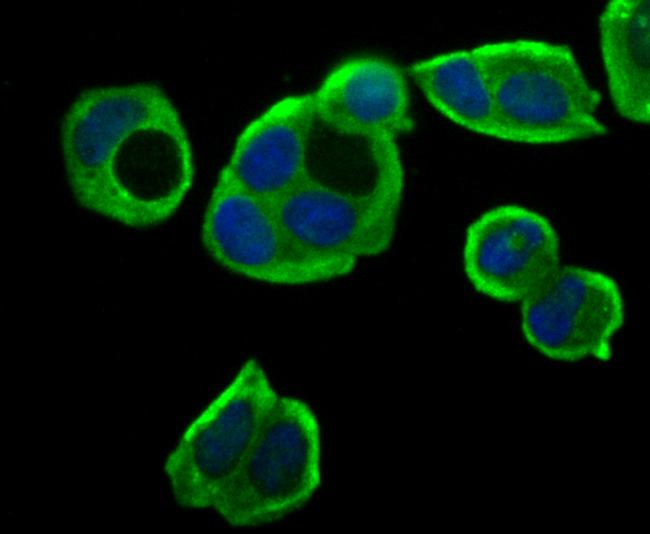 ASS1 Antibody in Immunocytochemistry (ICC/IF)