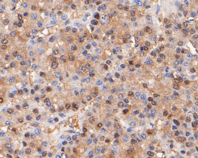 Thymidine Phosphorylase Antibody in Immunohistochemistry (Paraffin) (IHC (P))