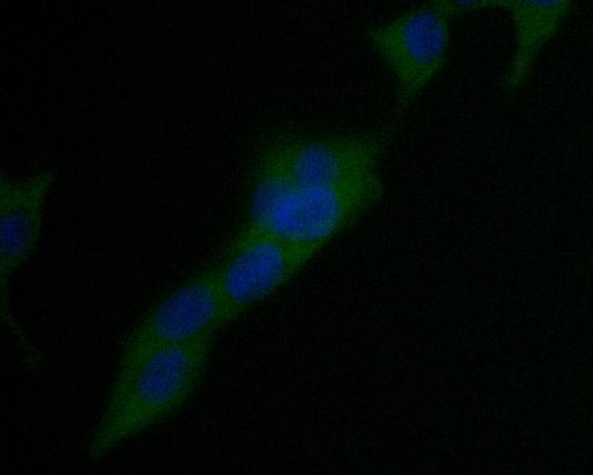 USP21 Antibody in Immunocytochemistry (ICC/IF)