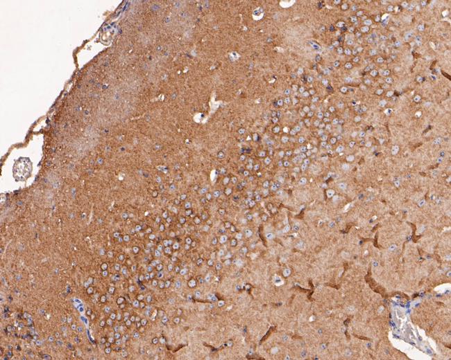 Dynamin 1 Antibody in Immunohistochemistry (Paraffin) (IHC (P))