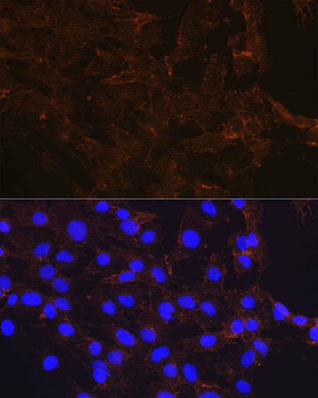 beta Catenin Antibody in Immunocytochemistry (ICC/IF)