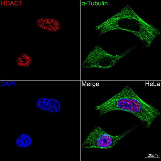 HDAC1 Antibody in Immunocytochemistry (ICC/IF)