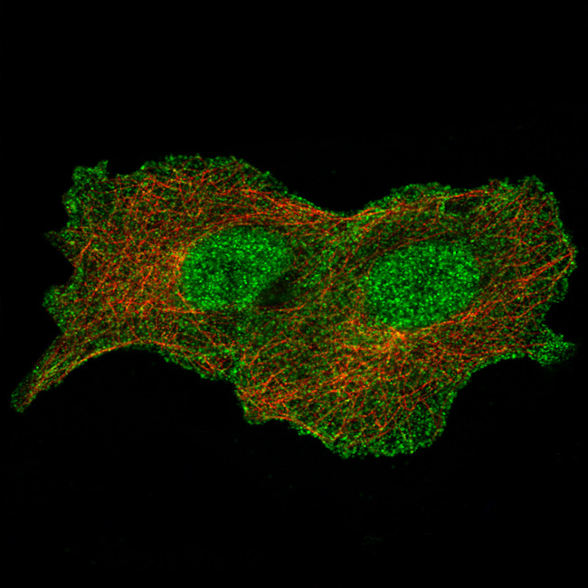 Annexin A1 Antibody in Immunocytochemistry (ICC/IF)