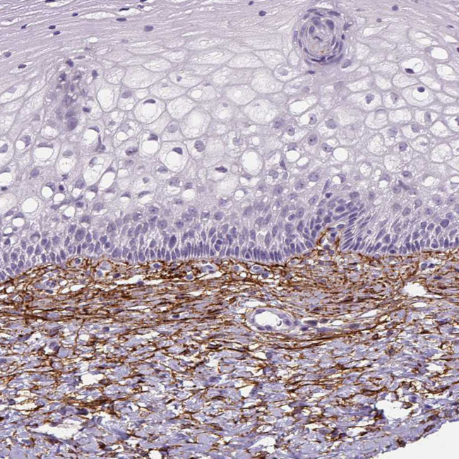 Fibrillin 1 Antibody in Immunohistochemistry (Paraffin) (IHC (P))