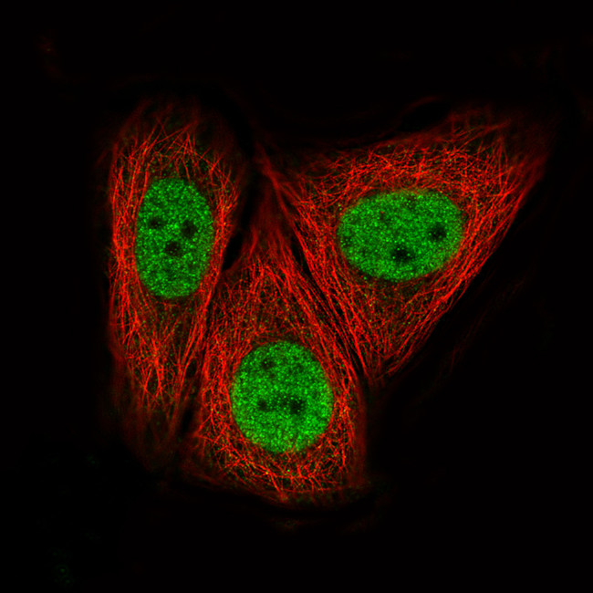 CTCF Antibody in Immunocytochemistry (ICC/IF)