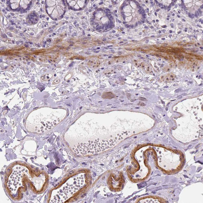 VEGF Receptor 1 Antibody in Immunohistochemistry (Paraffin) (IHC (P))