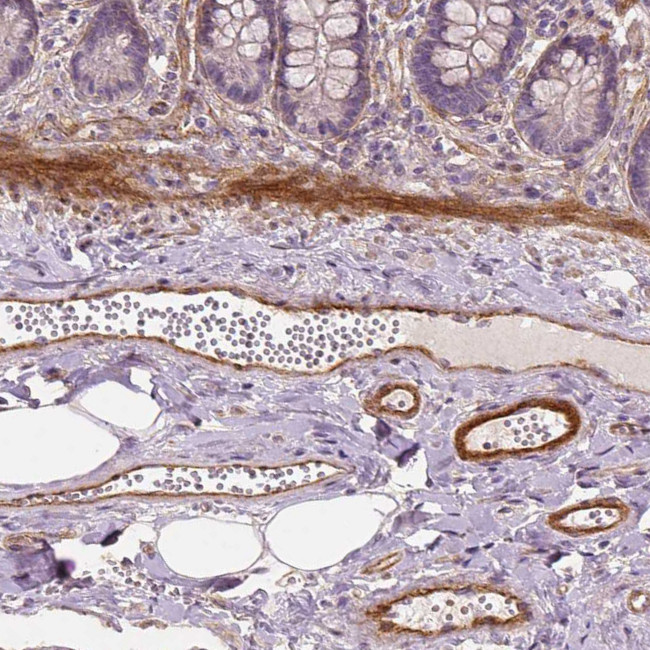 VEGF Receptor 1 Antibody in Immunohistochemistry (Paraffin) (IHC (P))