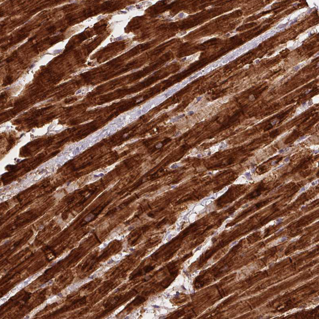 SDHB Antibody in Immunohistochemistry (Paraffin) (IHC (P))