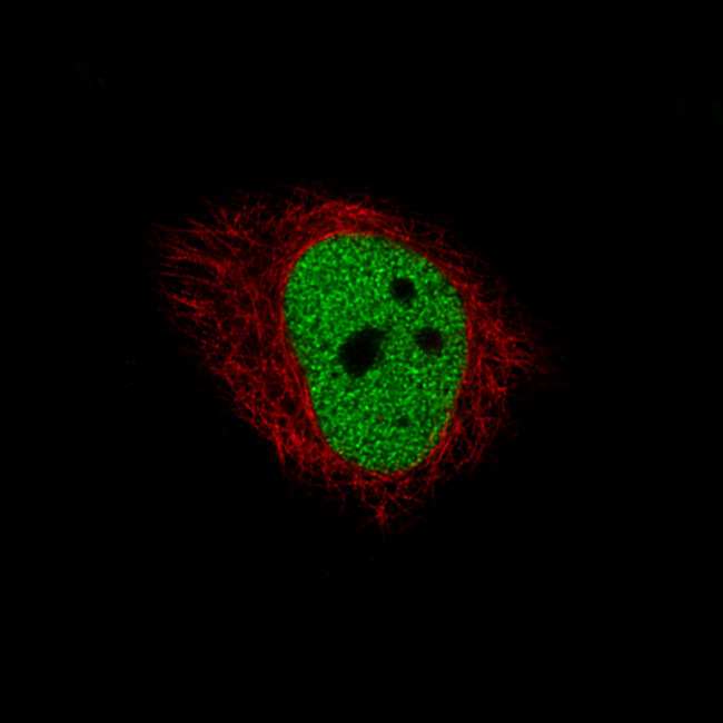 HDAC1 Antibody in Immunocytochemistry (ICC/IF)