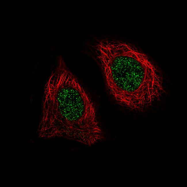 BRD4 Antibody in Immunocytochemistry (ICC/IF)