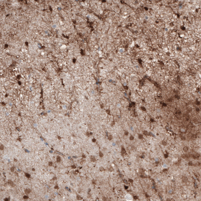 S100B Antibody in Immunohistochemistry (Paraffin) (IHC (P))