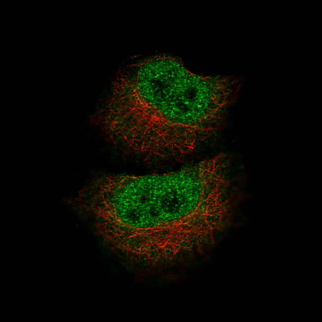 MBP Antibody in Immunocytochemistry (ICC/IF)