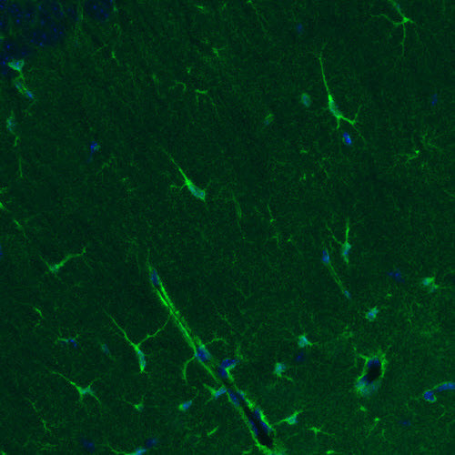 Glutamine Synthetase Antibody in Immunohistochemistry (Paraffin) (IHC (P))