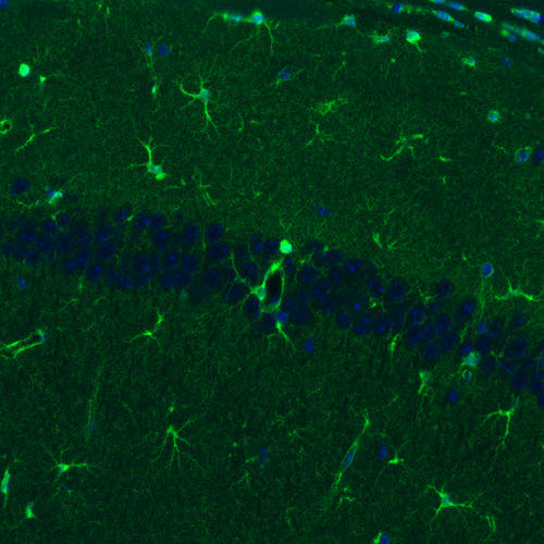 Glutamine Synthetase Antibody in Immunohistochemistry (Paraffin) (IHC (P))