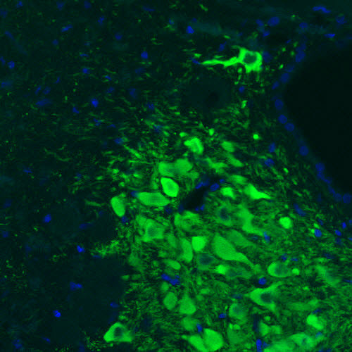 Tyrosine Hydroxylase Antibody in Immunohistochemistry (Paraffin) (IHC (P))