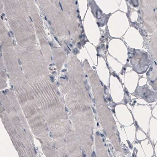 OATP8 Antibody in Immunohistochemistry (Paraffin) (IHC (P))