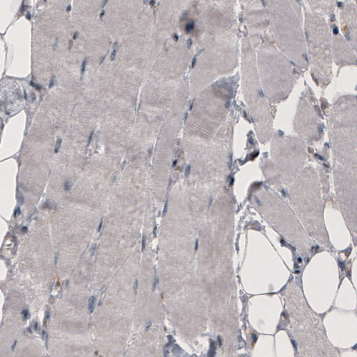 CD142 Antibody in Immunohistochemistry (Paraffin) (IHC (P))