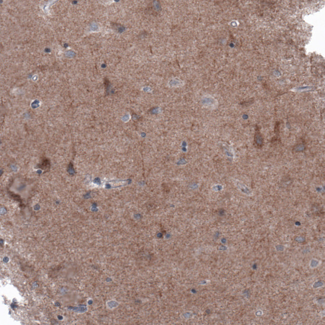 B-Raf Antibody in Immunohistochemistry (Paraffin) (IHC (P))