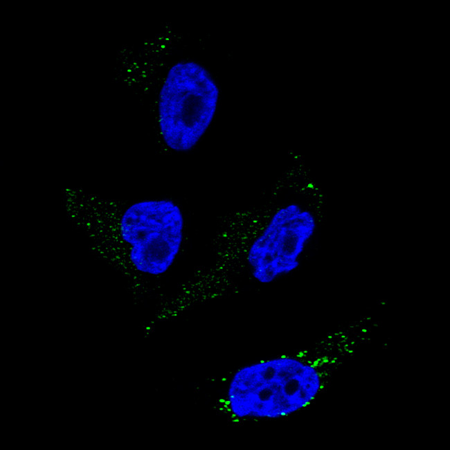 TYRP1 Antibody in Immunocytochemistry (ICC/IF)