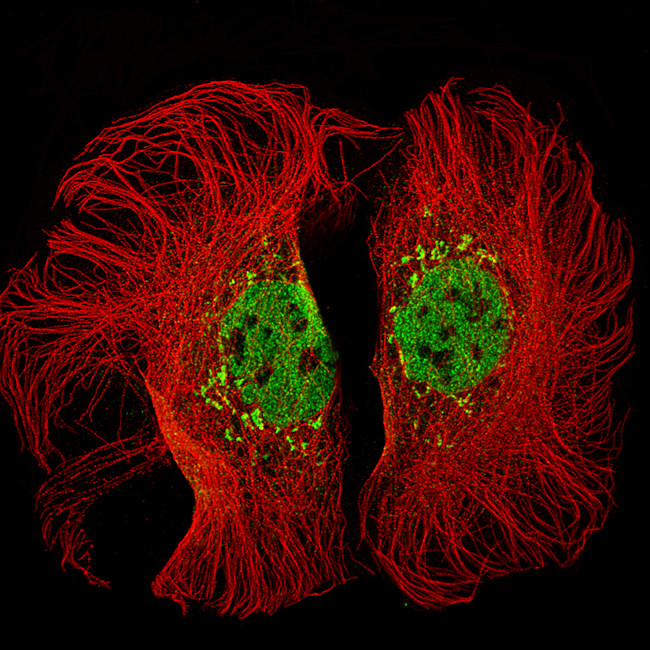 KMT2D Antibody in Immunocytochemistry (ICC/IF)