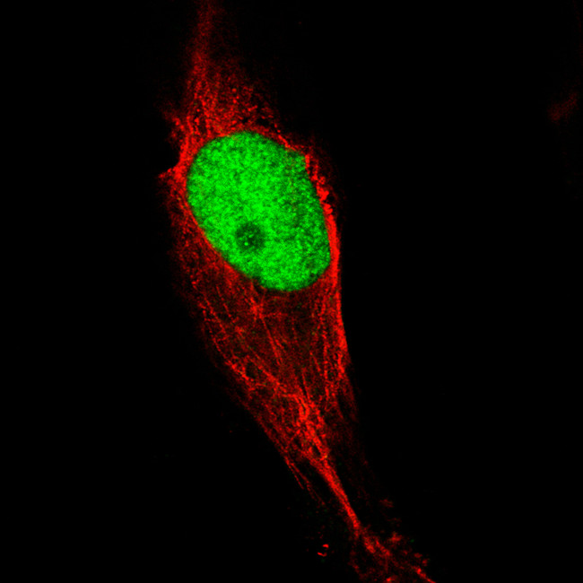 KLF4 Antibody in Immunocytochemistry (ICC/IF)