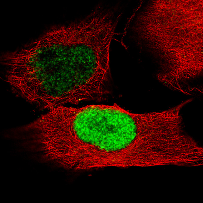 POU3F2 Antibody in Immunocytochemistry (ICC/IF)