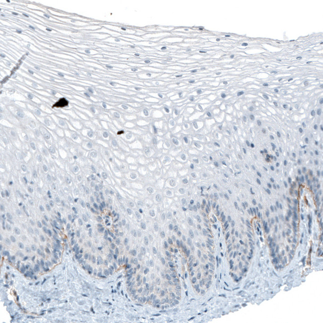 CD49f Antibody in Immunohistochemistry (Paraffin) (IHC (P))