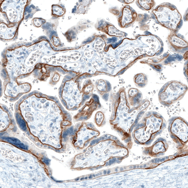 CD104 Antibody in Immunohistochemistry (Paraffin) (IHC (P))