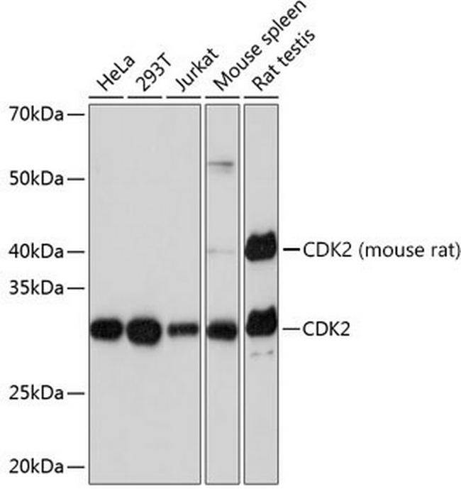 CDK2 Antibody in Western Blot (WB)