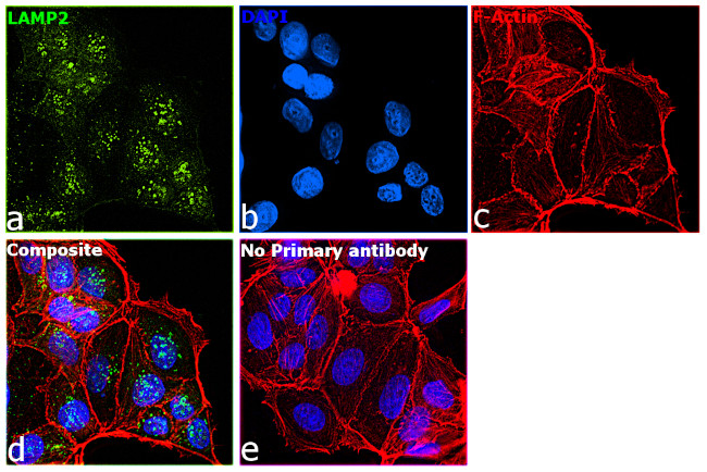 LAMP2 Antibody in Immunocytochemistry (ICC/IF)