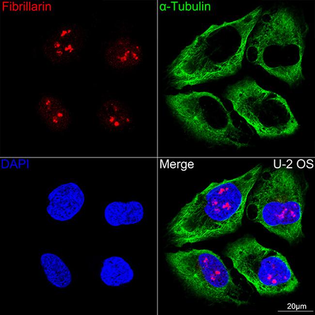 Fibrillarin Antibody in Immunocytochemistry (ICC/IF)