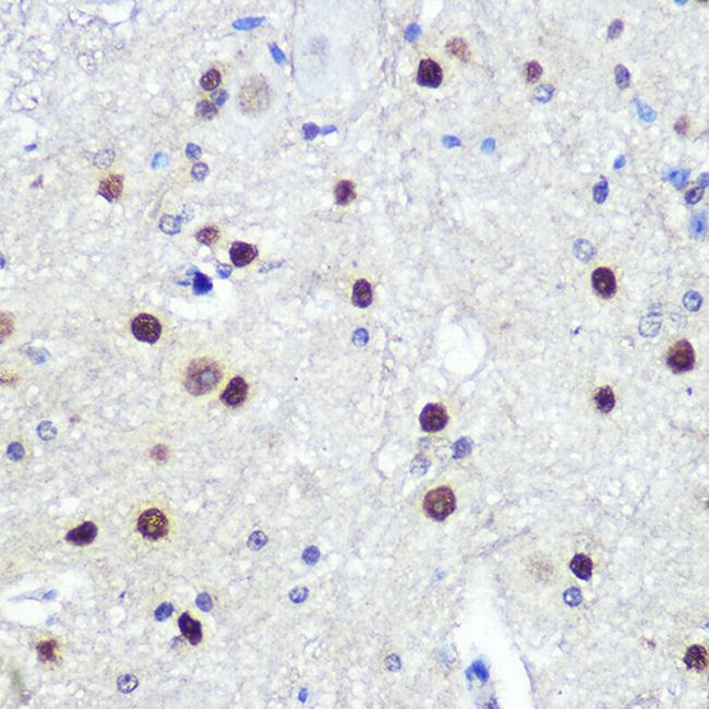 HES1 Antibody in Immunohistochemistry (Paraffin) (IHC (P))