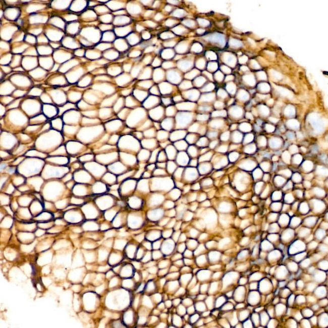 EpCAM Antibody in Immunohistochemistry (Paraffin) (IHC (P))