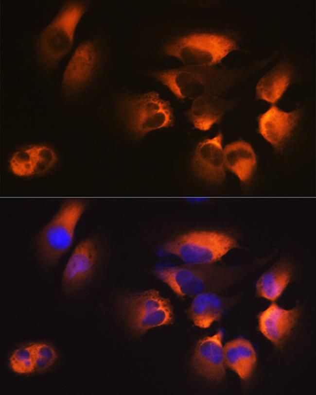 AP2M1 Antibody in Immunocytochemistry (ICC/IF)