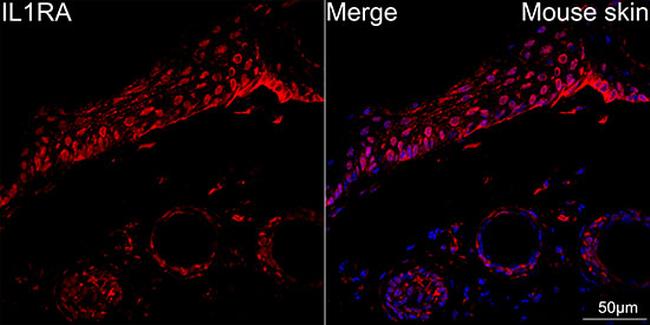 IL1RA Antibody in Immunohistochemistry (Paraffin) (IHC (P))