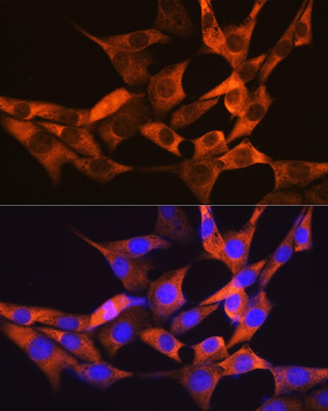 FABP1 Antibody in Immunocytochemistry (ICC/IF)