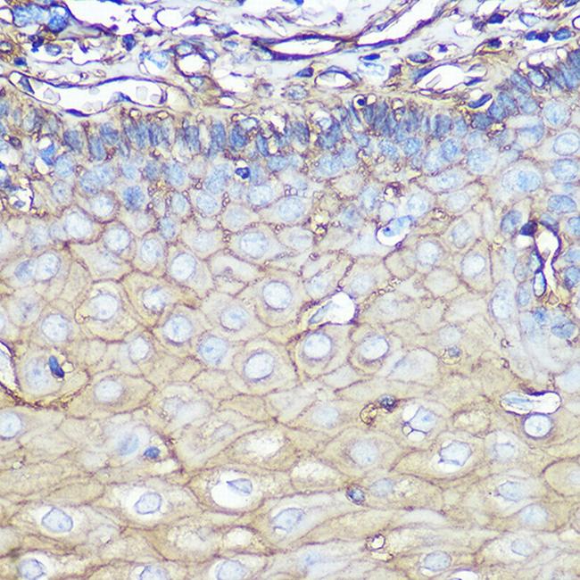 Annexin A2 Antibody in Immunohistochemistry (Paraffin) (IHC (P))